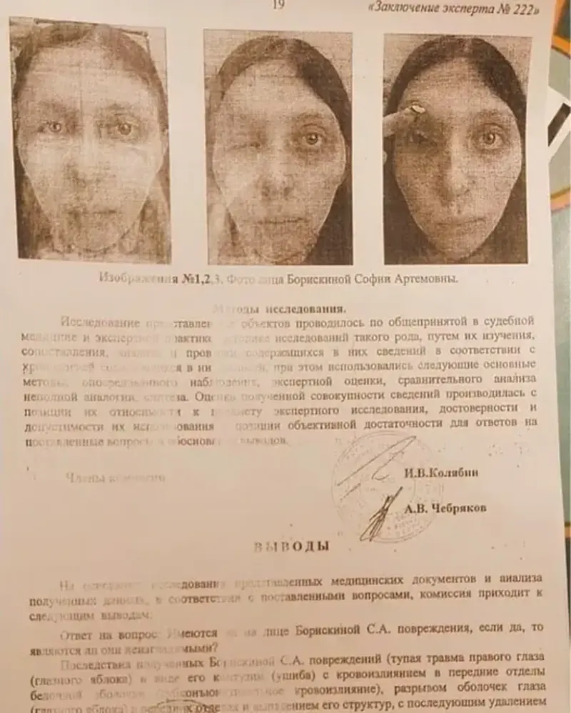 ekspertiza 1